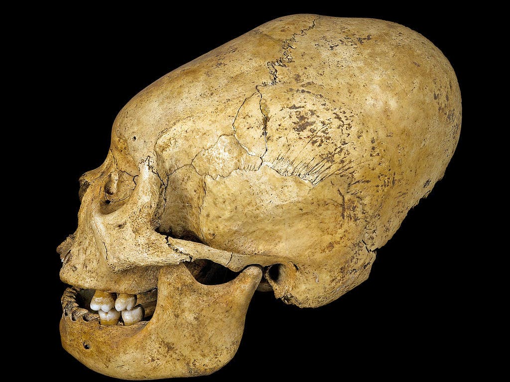 Ancient Peruvians gave themselves elongated skulls as a mark of status |  The Independent | The Independent