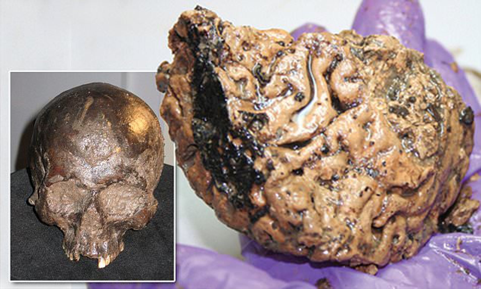 2,600-year-old human BRAIN was preserved thanks to oxygen-free clay mud in York | Daily Mail Online