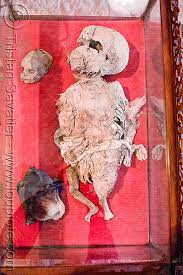 Mummified Body of a Child