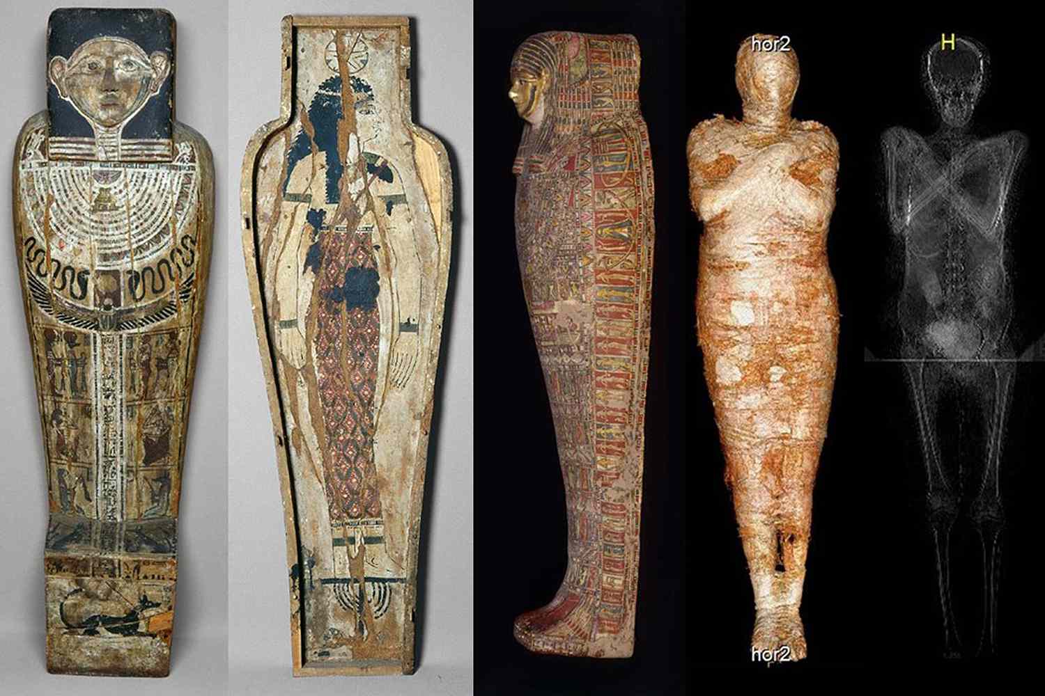 Researchers Find World's First Pregnant Mummy