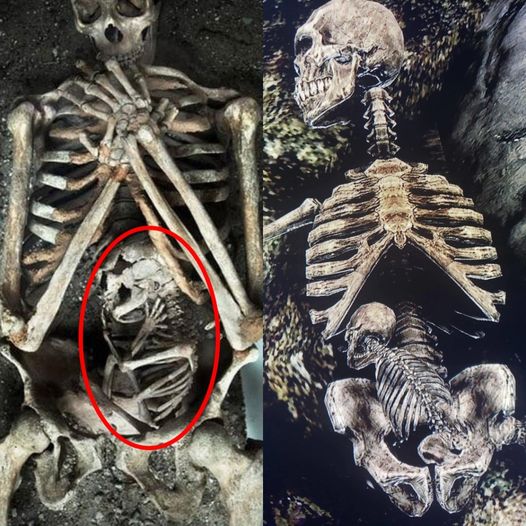 Skeleton of Pregnant Mother and Her Unborn Child Sheds Light