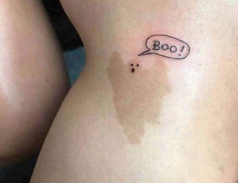 Tatuajes para disimular cicatrices Tatuajes para disimular cicatrices