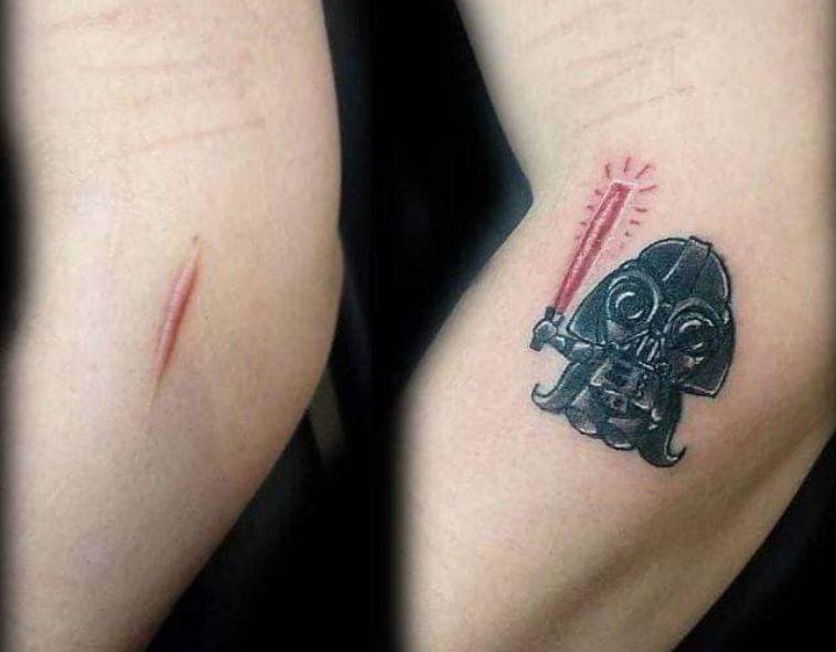 Tatuajes para disimular cicatrices Tatuajes para disimular cicatrices