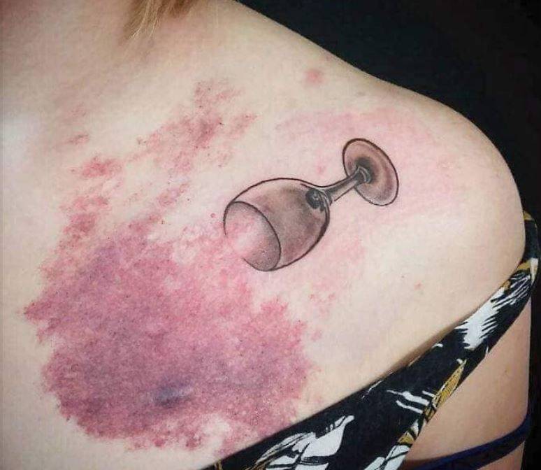 Tatuajes para disimular cicatrices Tatuajes para disimular cicatrices